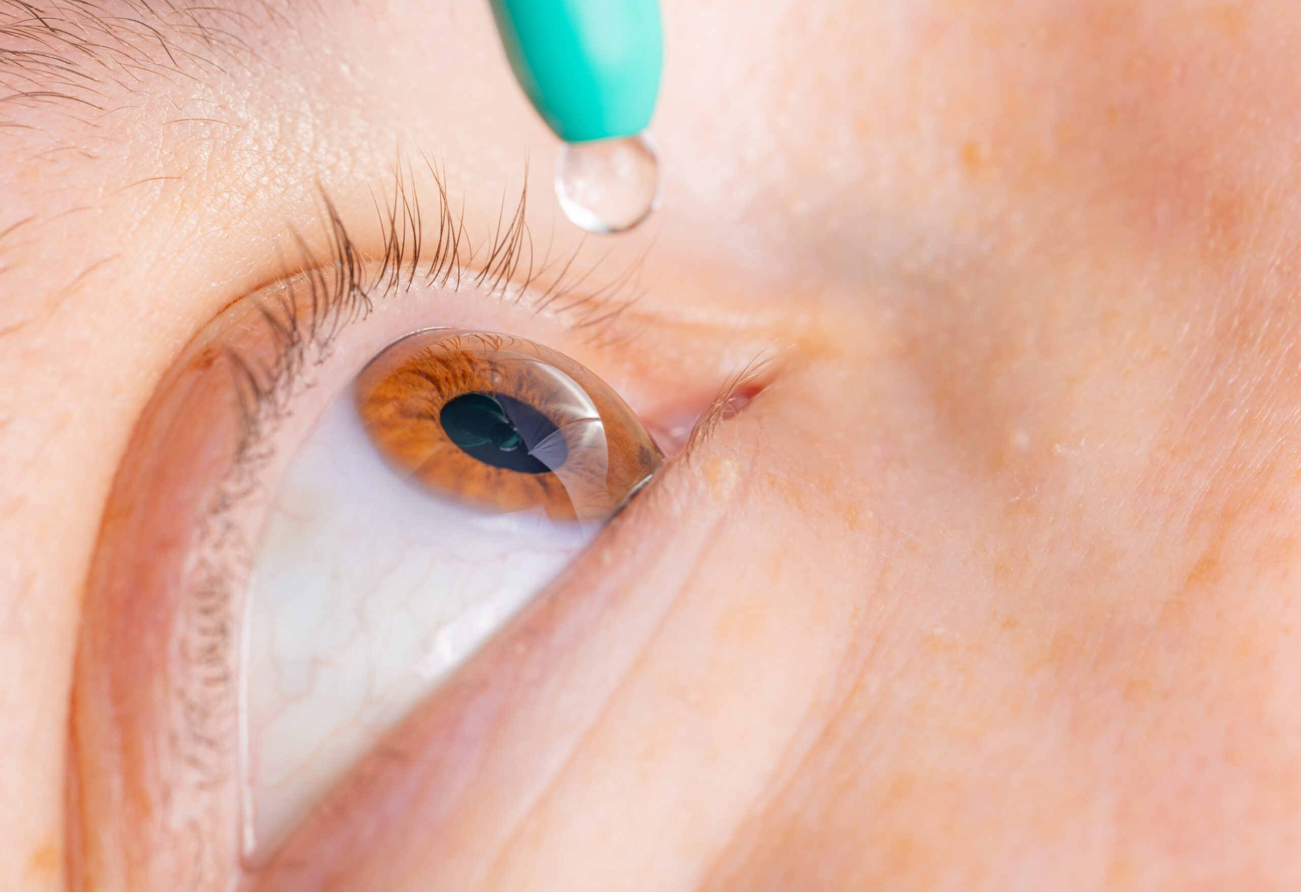Ophthalmics